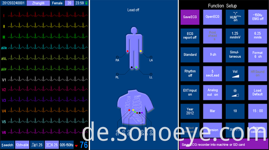 6 Channel electrocardiograph Machine